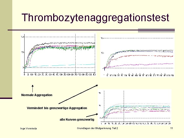 Thrombozytenaggregationstest Normale Aggregation Vermindert bis grenzwertige Aggregation alle Kurven grenzwertig Inge Vonnieda Grundlagen der