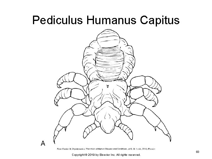 Pediculus Humanus Capitus Copyright © 2019 by Elsevier Inc. All rights reserved. 83 