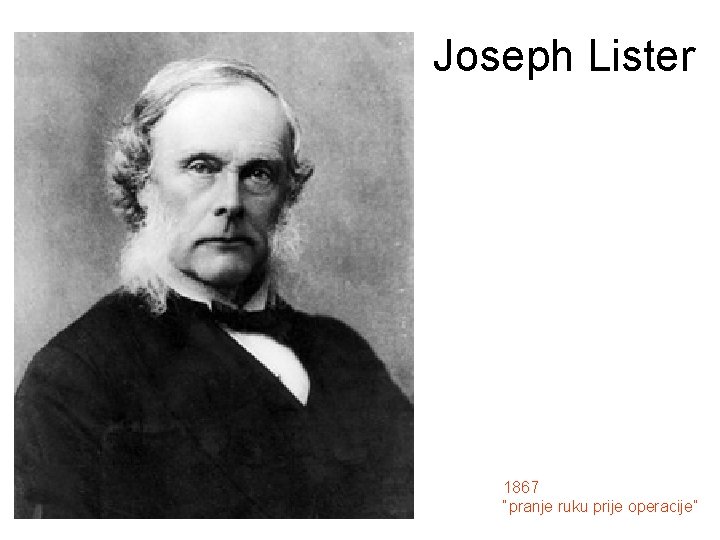 Joseph Lister 1867 “pranje ruku prije operacije” 