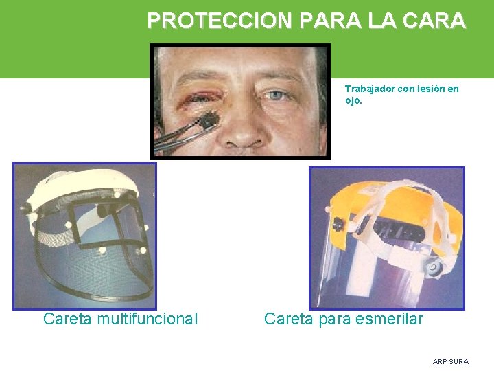 PROTECCION PARA LA CARA Trabajador con lesión en ojo. Careta multifuncional Careta para esmerilar