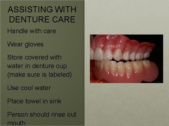 ASSISTING WITH DENTURE CARE Handle with care Wear gloves Store covered with water in