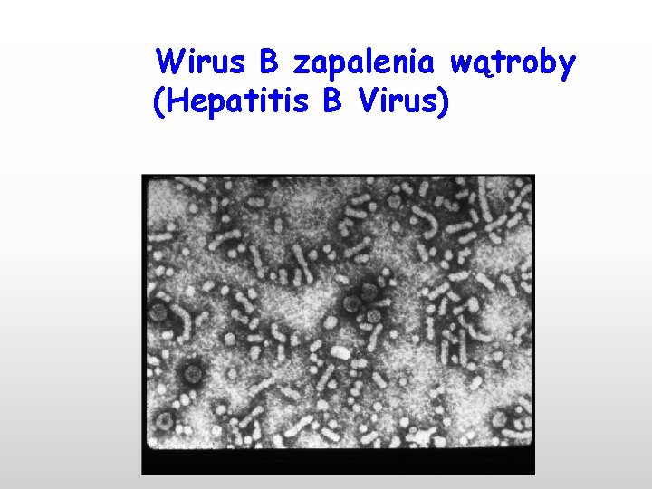 Wirus B zapalenia wątroby (Hepatitis B Virus) 