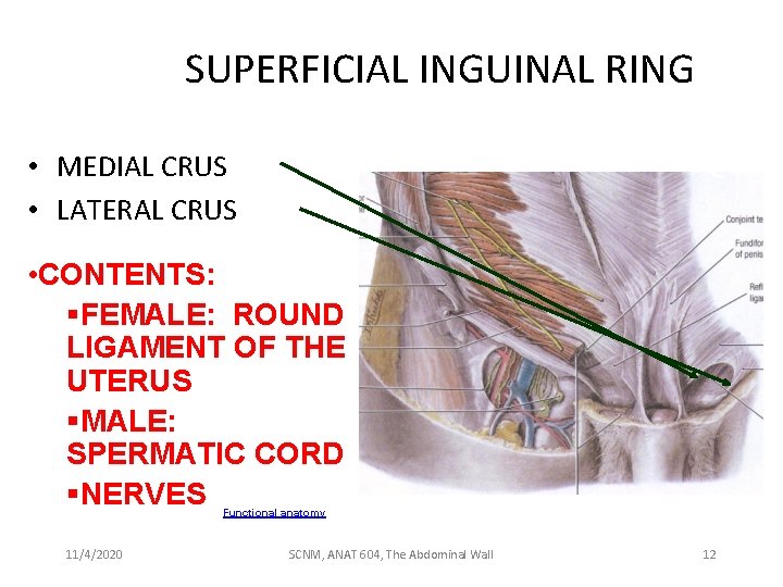 SUPERFICIAL INGUINAL RING • MEDIAL CRUS • LATERAL CRUS • CONTENTS: §FEMALE: ROUND LIGAMENT