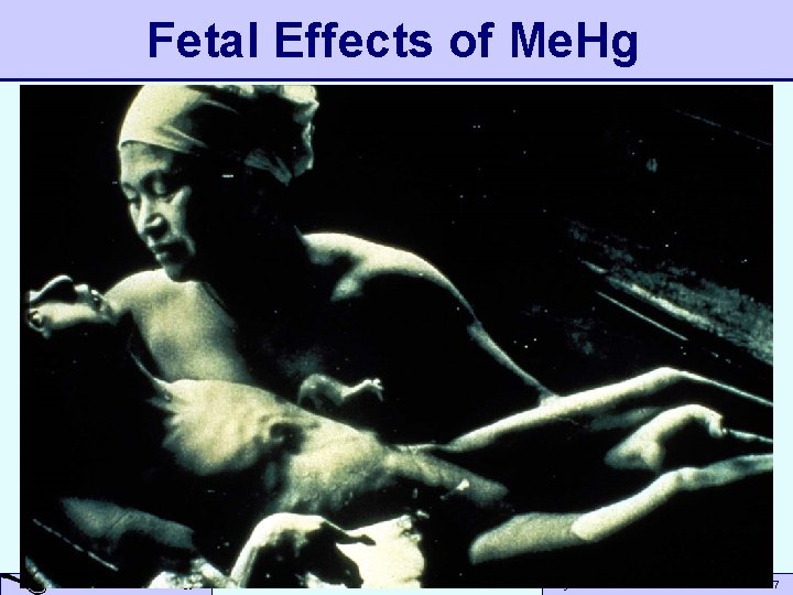 Fetal Effects of Me. Hg A Small Dose of Toxicology Beyond Risk Assessment to