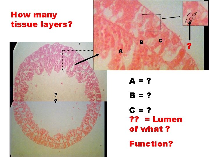 How many tissue layers? B C A A=? ? ? B=? C=? ? ?