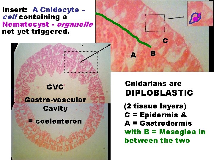Insert: A Cnidocyte – cell containing a Nematocyst - organelle not yet triggered. C