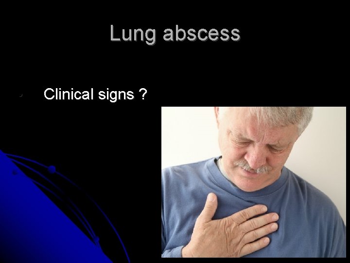 Lung abscess • Clinical signs ? 