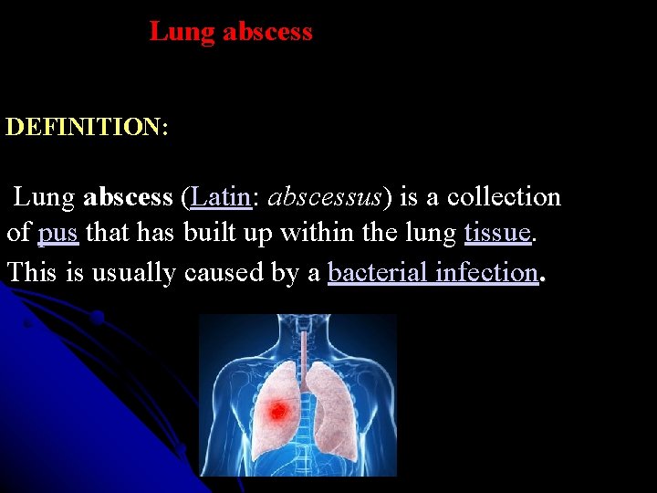 Lung abscess DEFINITION: Lung abscess (Latin: abscessus) is a collection of pus that has