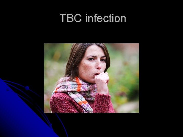 TBC infection 