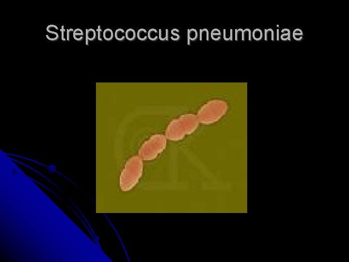 Streptococcus pneumoniae Streptococcus pneumoniae