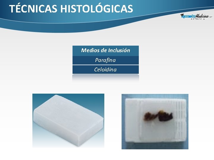 TÉCNICAS HISTOLÓGICAS Medios de Inclusión Parafina Celoidina 