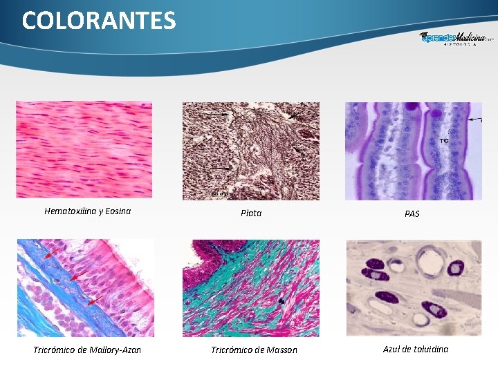 COLORANTES Hematoxilina y Eosina Tricrómico de Mallory-Azan Plata Tricrómico de Masson PAS Azul de
