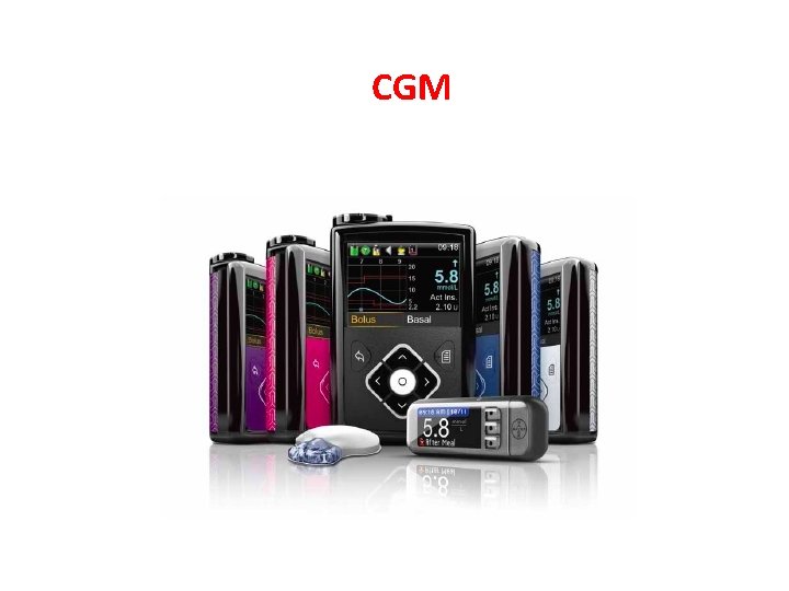 CGM 