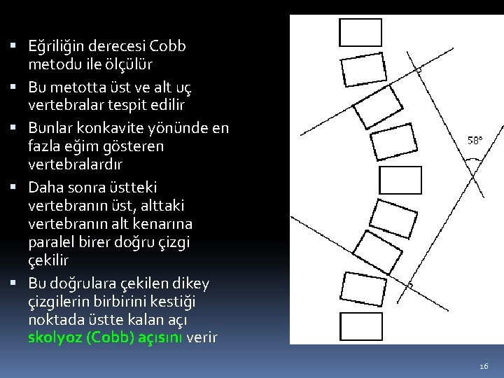  Eğriliğin derecesi Cobb metodu ile ölçülür Bu metotta üst ve alt uç vertebralar