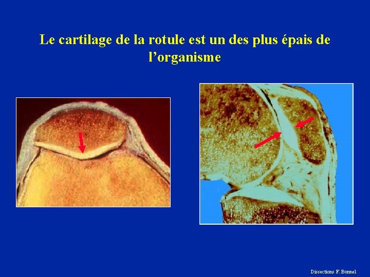 Le cartilage de la rotule est un des plus épais de l’organisme Dissections F.