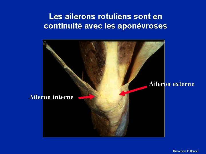 Les ailerons rotuliens sont en continuité avec les aponévroses Aileron externe Aileron interne Dissections