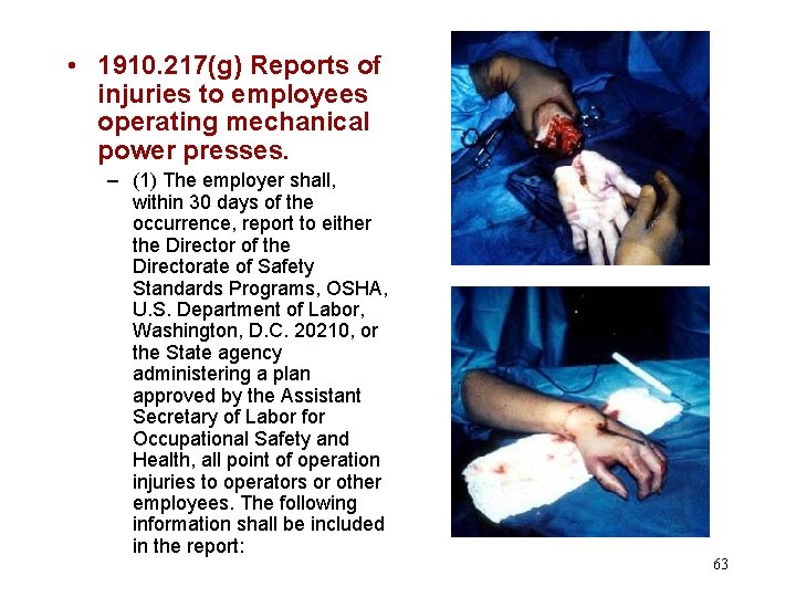  • 1910. 217(g) Reports of injuries to employees operating mechanical power presses. –