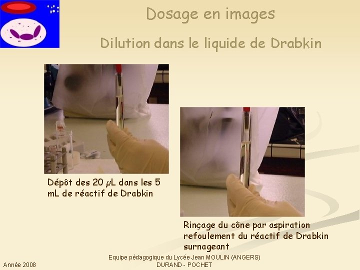 Dosage en images Dilution dans le liquide de Drabkin Dépôt des 20 µL dans