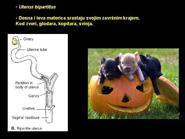  • Uterus bipartitus • Desna i leva materica srastaju svojim završnim krajem. Kod