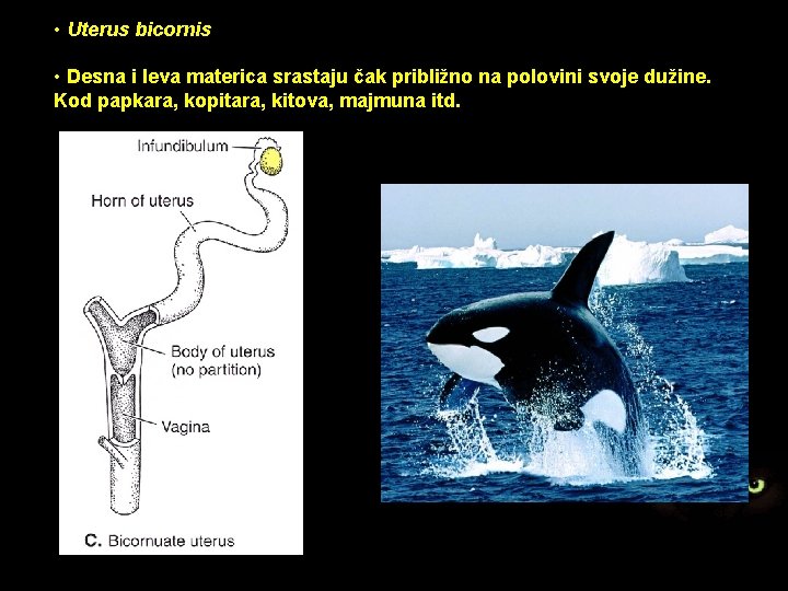  • Uterus bicornis • Desna i leva materica srastaju čak približno na polovini