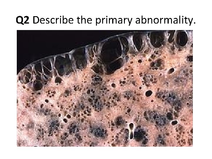 Q 2 Describe the primary abnormality. Q 2 Describe the primary abnormality.