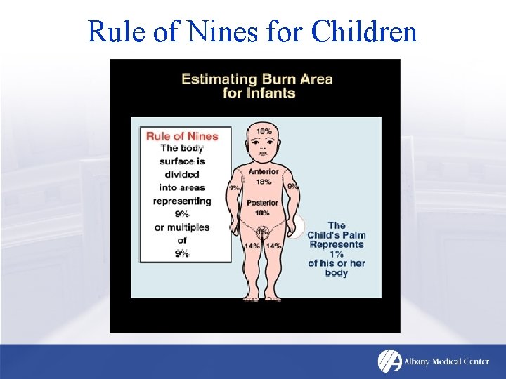 Rule of Nines for Children 