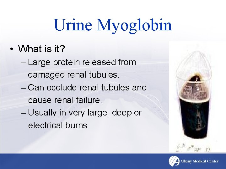 Urine Myoglobin • What is it? – Large protein released from damaged renal tubules.