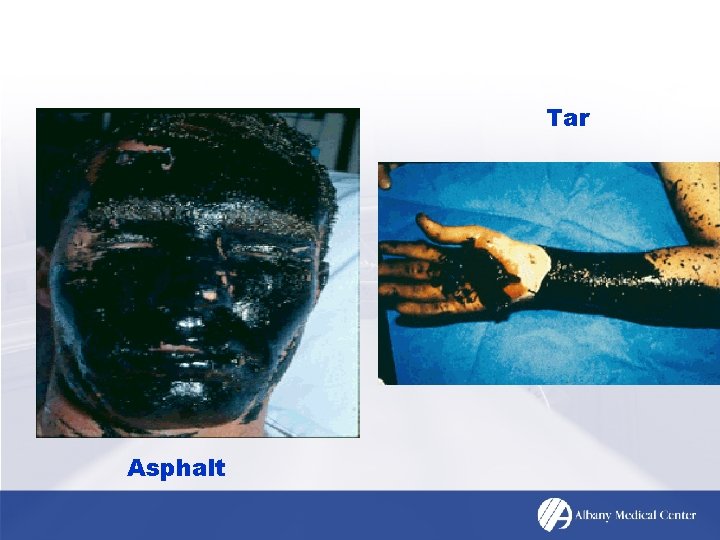 Tar Asphalt 