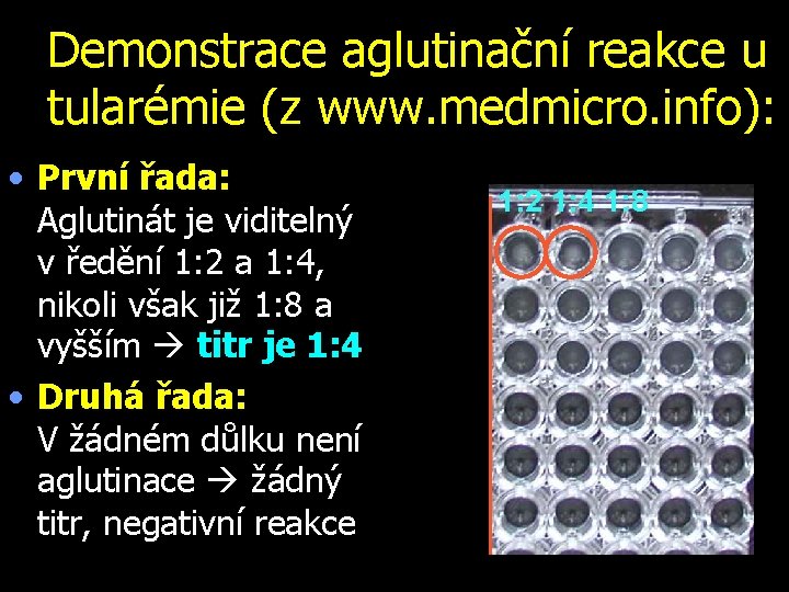 Demonstrace aglutinační reakce u tularémie (z www. medmicro. info): • První řada: Aglutinát je