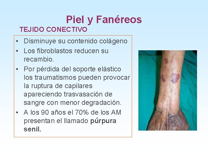 Piel y Fanéreos TEJIDO CONECTIVO • Disminuye su contenido colágeno • Los fibroblastos reducen