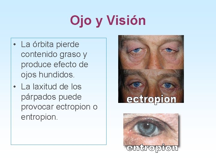 Ojo y Visión • La órbita pierde contenido graso y produce efecto de ojos