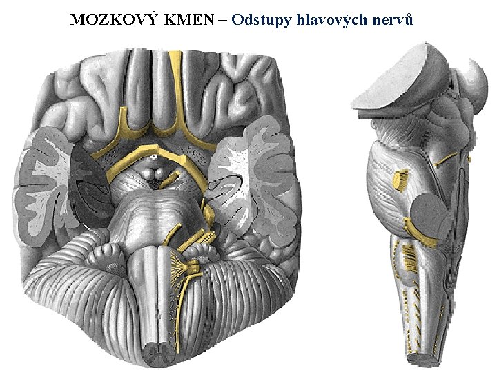 MOZKOVÝ KMEN – Odstupy hlavových nervů 
