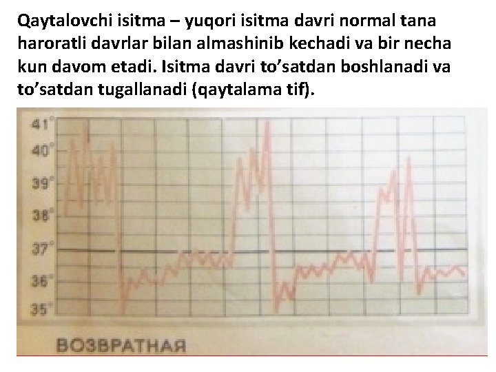 Qaytalovchi isitma – yuqori isitma davri normal tana haroratli davrlar bilan almashinib kechadi va