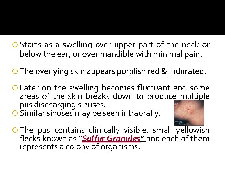  Starts as a swelling over upper part of the neck or below the