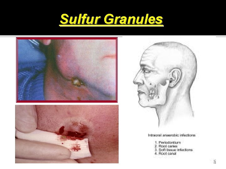 Sulfur Granules 