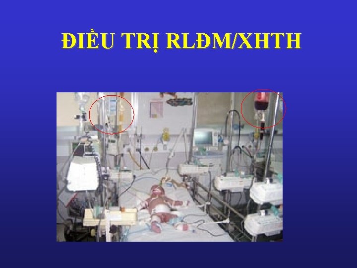 ĐIỀU TRỊ RLĐM/XHTH 