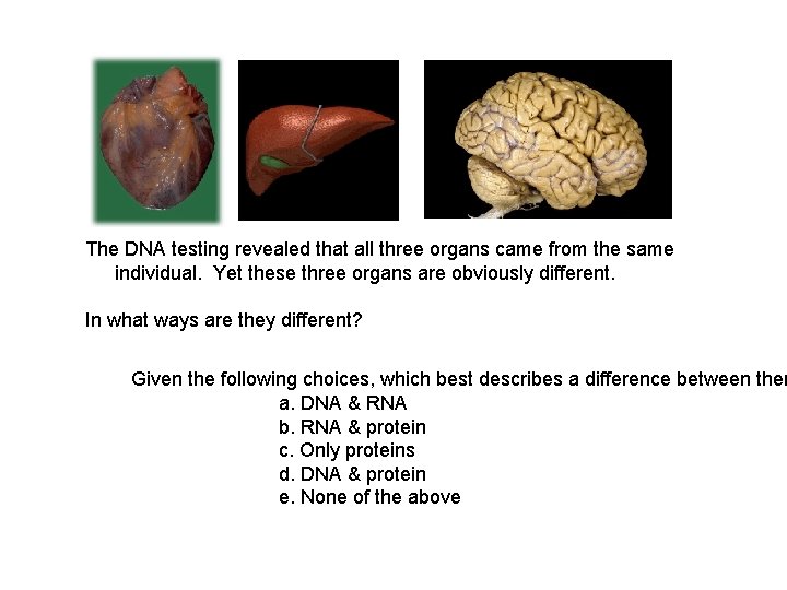 The DNA testing revealed that all three organs came from the same individual. Yet