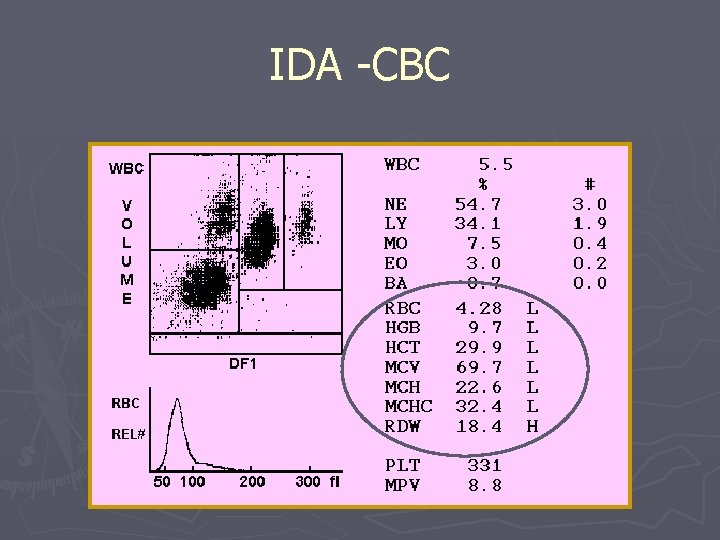 IDA -CBC 