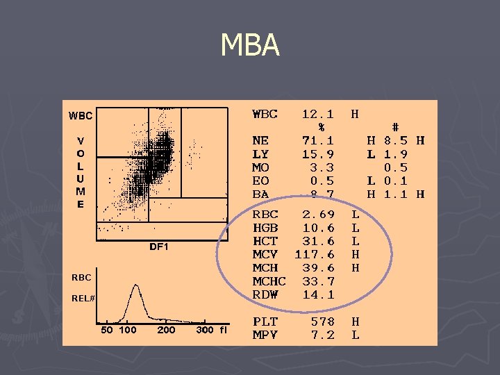 MBA 