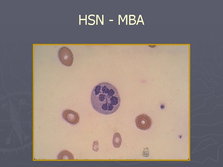 HSN - MBA 