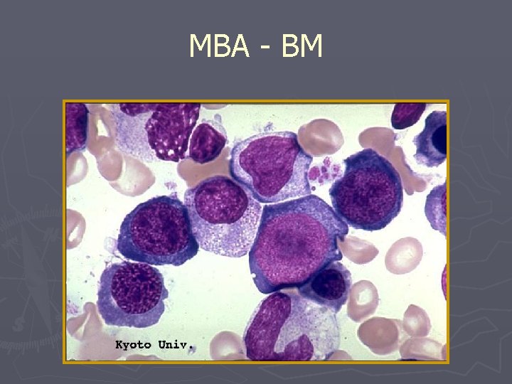 MBA - BM 