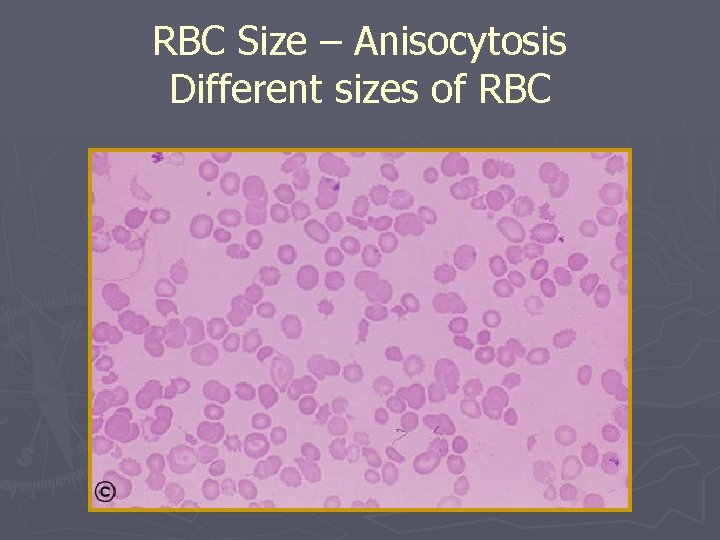 RBC Size – Anisocytosis Different sizes of RBC 