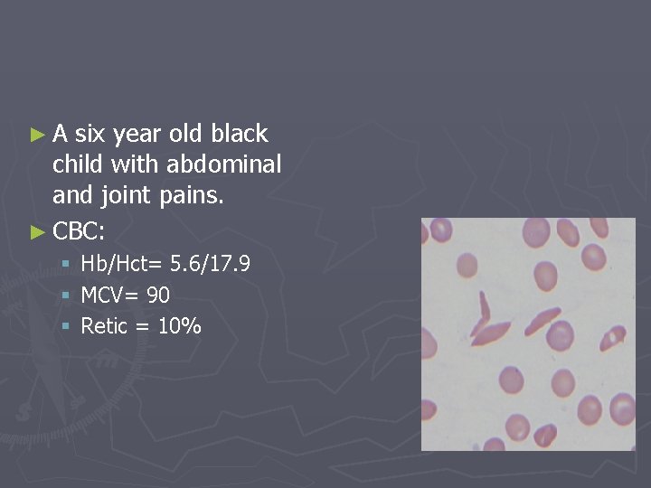 ► A six year old black child with abdominal and joint pains. ► CBC:
