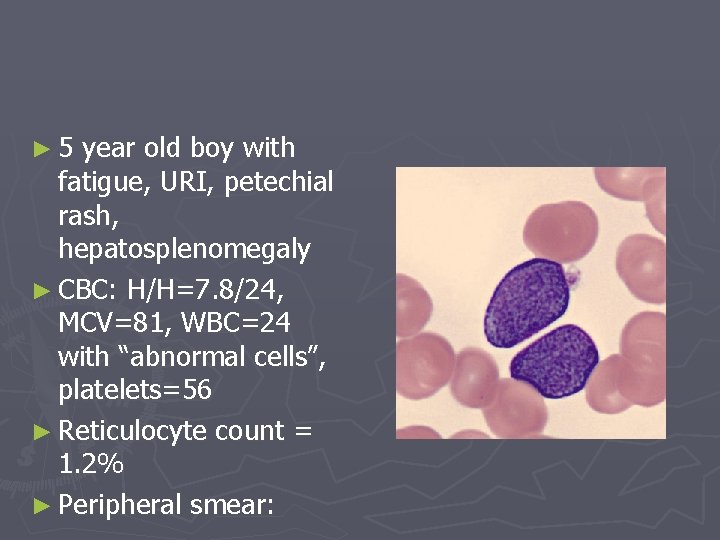 ► 5 year old boy with fatigue, URI, petechial rash, hepatosplenomegaly ► CBC: H/H=7.