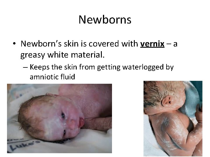 Newborns • Newborn’s skin is covered with vernix – a greasy white material. –