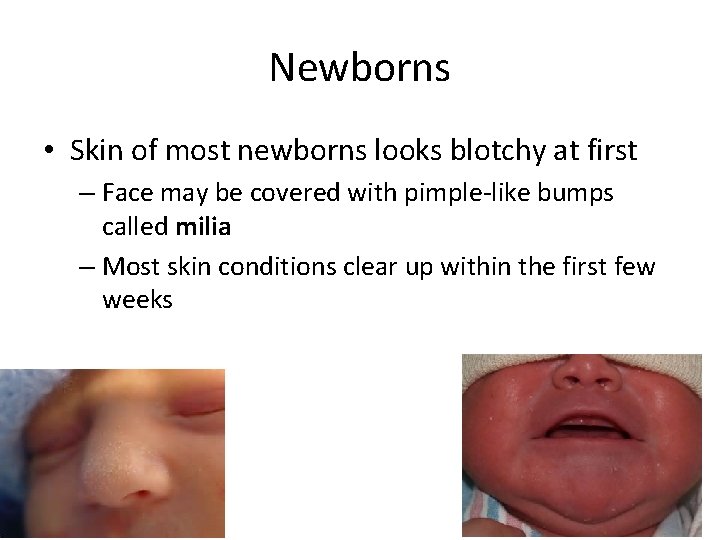 Newborns • Skin of most newborns looks blotchy at first – Face may be