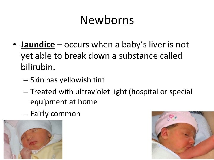 Newborns • Jaundice – occurs when a baby’s liver is not yet able to
