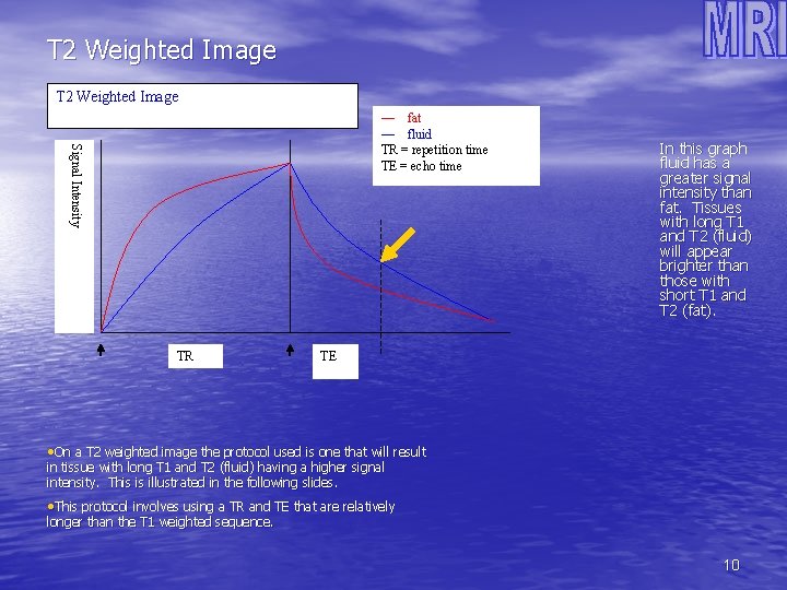 T 2 Weighted Image—long TR and TE Signal Intensity — fat — fluid TR