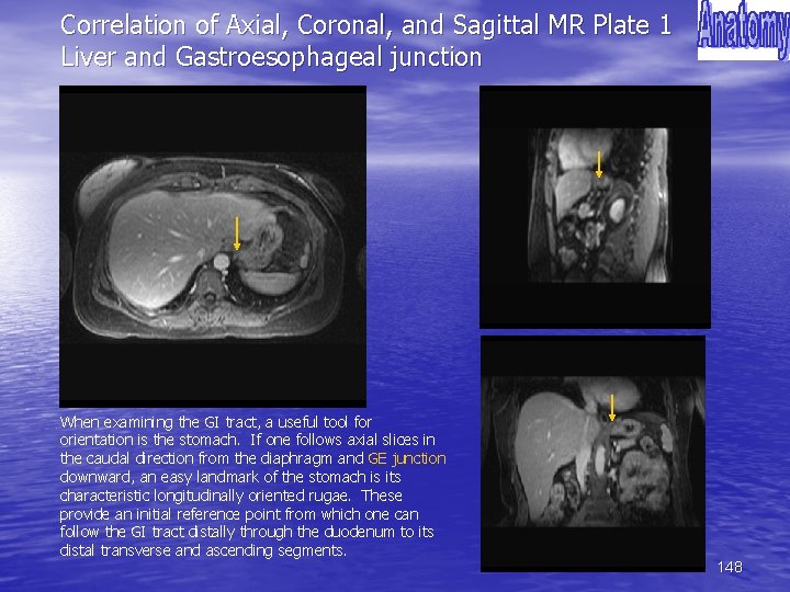 Correlation of Axial, Coronal, and Sagittal MR Plate 1 Liver and Gastroesophageal junction When