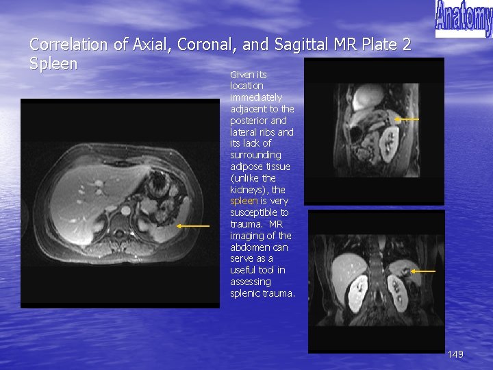 Correlation of Axial, Coronal, and Sagittal MR Plate 2 Spleen Given its location immediately